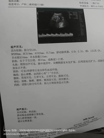 journal_insert_pic_1846842804