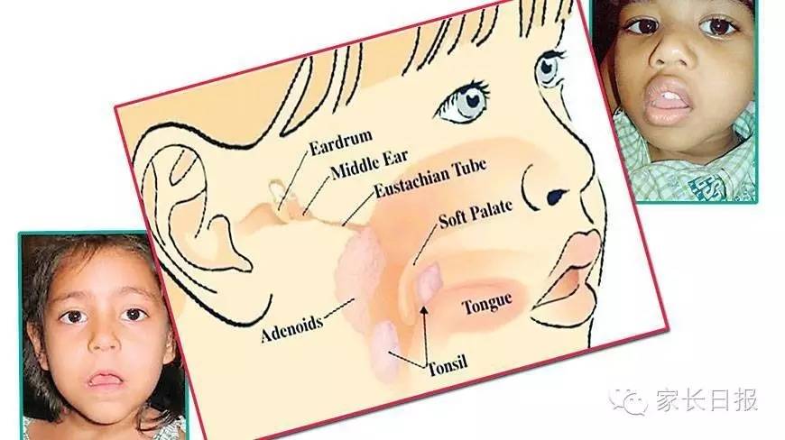 家长都会忽略的细节,导致孩子越长越丑、发育