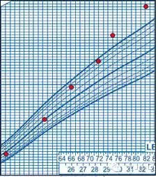 宝宝是不是太轻了?-- 美国营养师教我看懂生长曲线