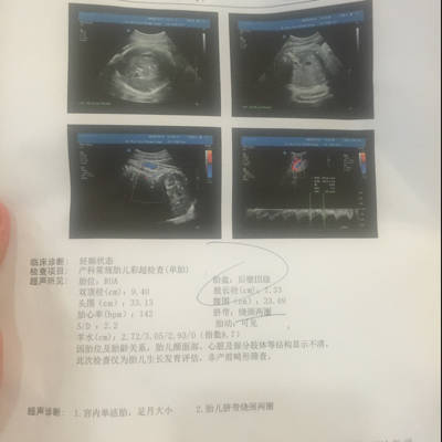 journal_insert_pic_545234151