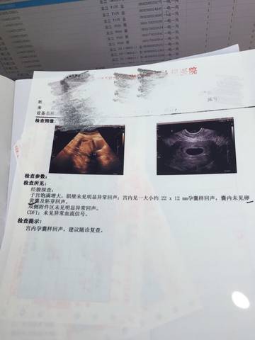 journal_insert_pic_545480404