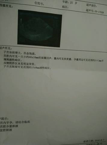 journal_insert_pic_546255066