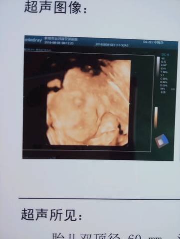 journal_insert_pic_546895360