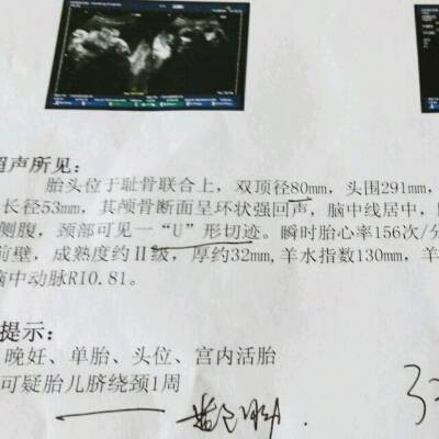 journal_insert_pic_548293142