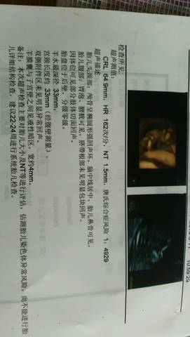 journal_insert_pic_549083411