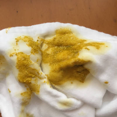 帮我看看宝宝是不是拉稀了,宝宝五十天了