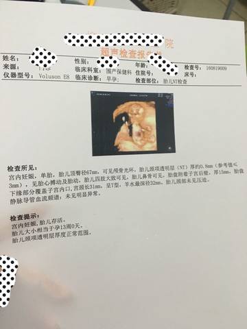 journal_insert_pic_556012974