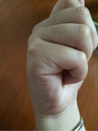 1.右手握拳侧面照(如图) 2.