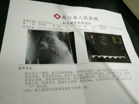 journal_insert_pic_556315448