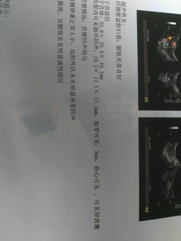 journal_insert_pic_557884157