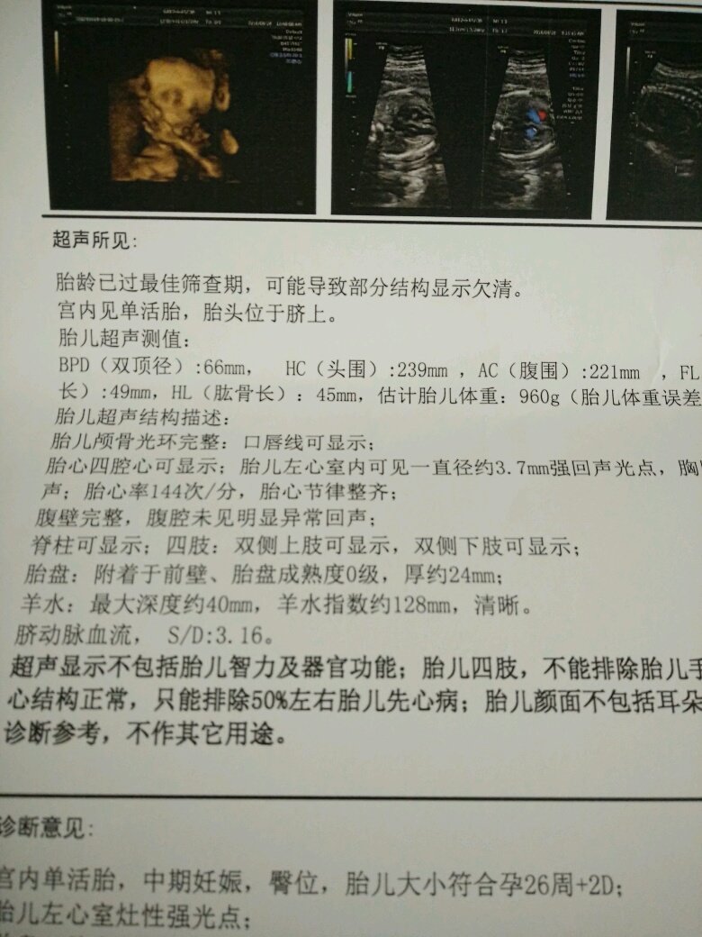 四维不是很清楚，是怎么回事？