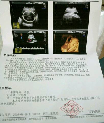 journal_insert_pic_563828069