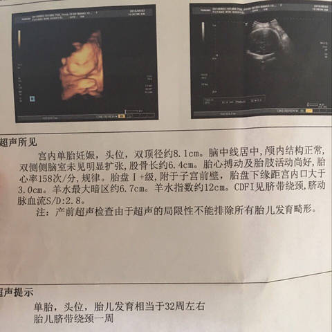 journal_insert_pic_564220315