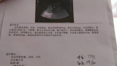 journal_insert_pic_565468795