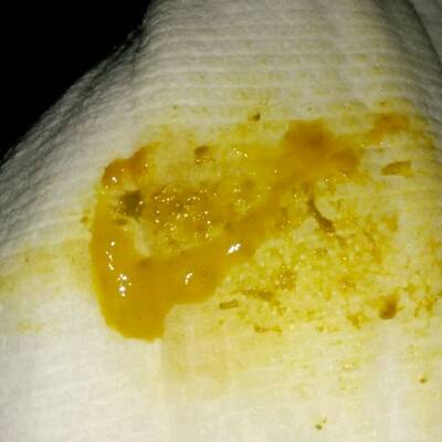 像大人便秘一样,昨晚哽一个晚上,早上才拉出这么一点,像鼻涕