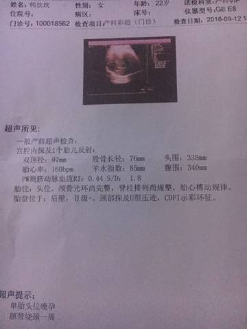 journal_insert_pic_569885122