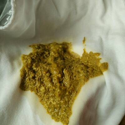 这种便便是拉肚子吗?是受凉吗?