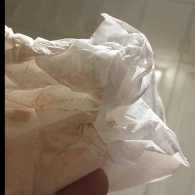 我怀孕五周的时候下面流血,b超说有宫腔积血,在医院住了九天,回来卧床