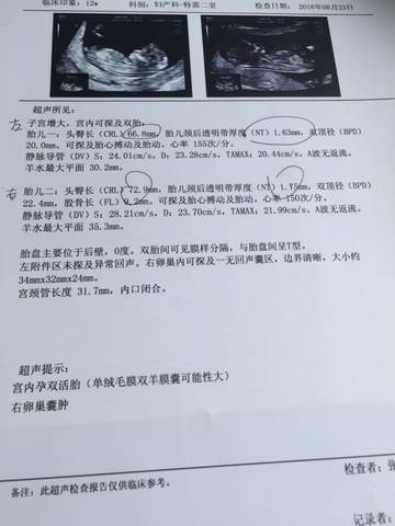 journal_insert_pic_570912364