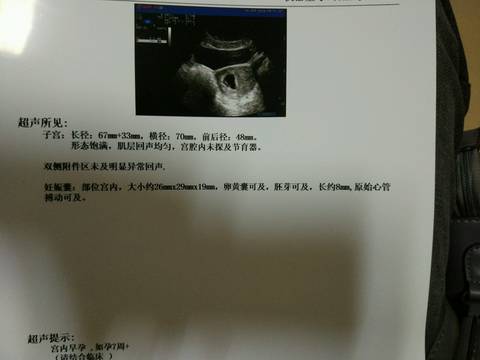 journal_insert_pic_571898848