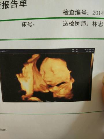 journal_insert_pic_572240996