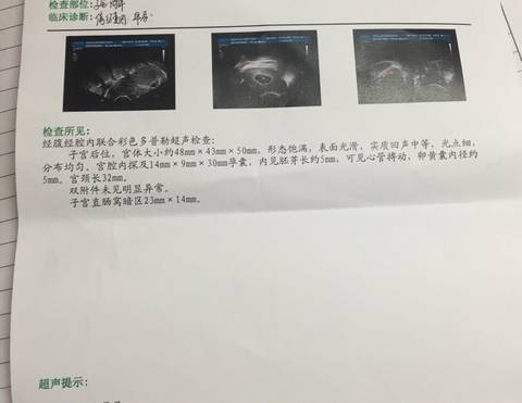 journal_insert_pic_575428045