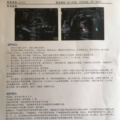 胎儿27周,发现盆腔异位肾,可能发育不良,膀胱左侧无回声暗区,考虑输尿