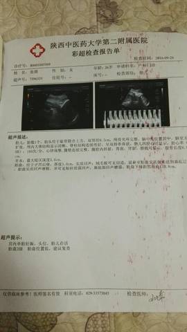journal_insert_pic_575831998