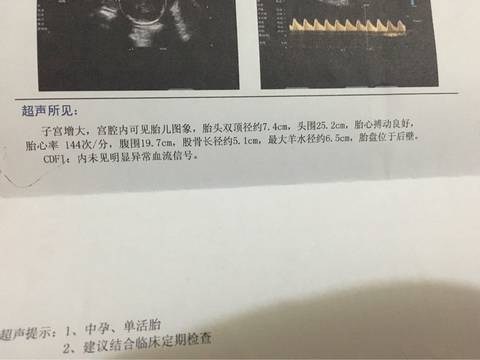 journal_insert_pic_577056014