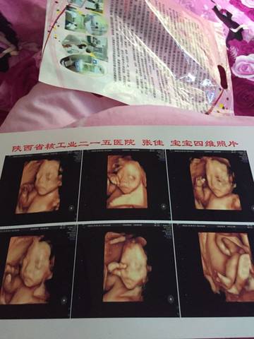 journal_insert_pic_577349454