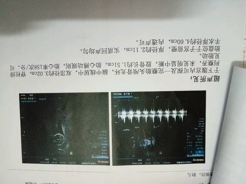 journal_insert_pic_577324094