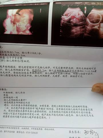 journal_insert_pic_577427700