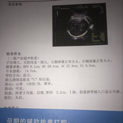 journal_insert_pic_578108108