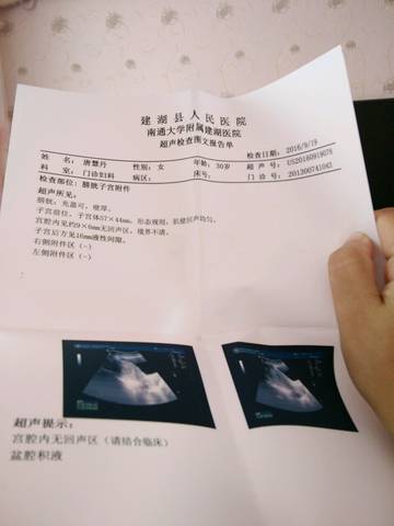 journal_insert_pic_577997300