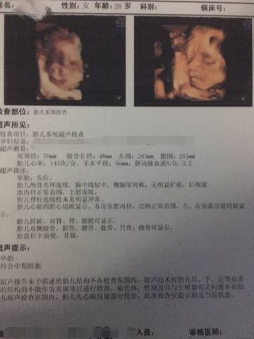 journal_insert_pic_581115573