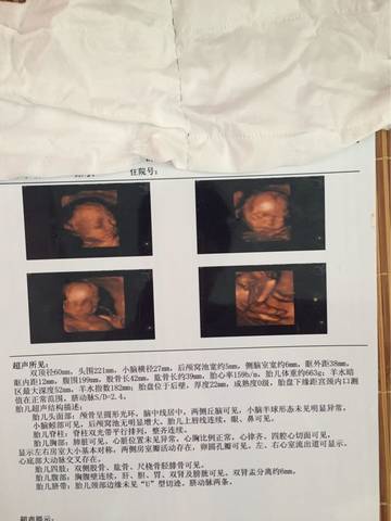 journal_insert_pic_581112739