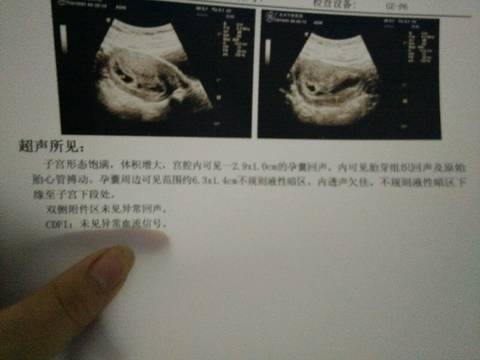 journal_insert_pic_581876180