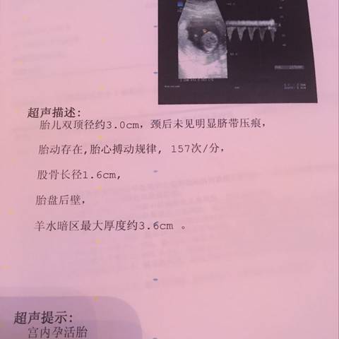 journal_insert_pic_582619343