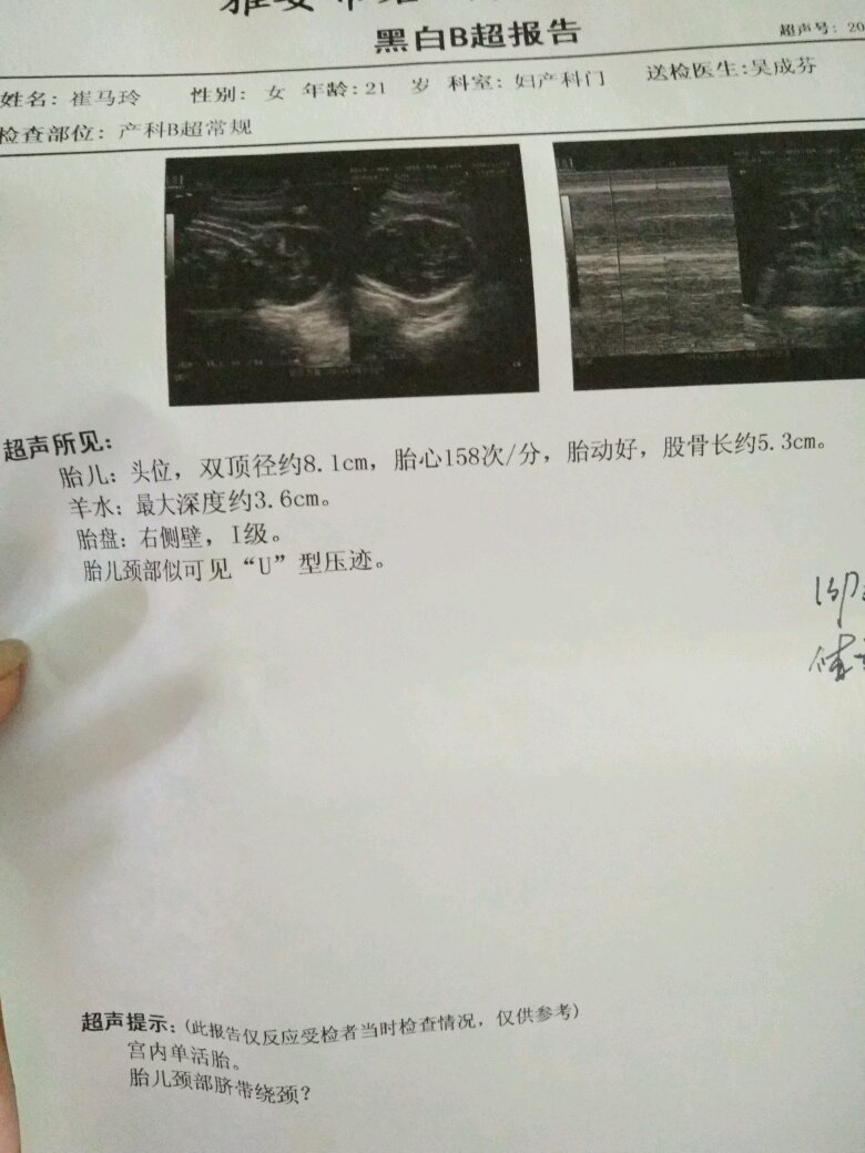 30周的检查结果