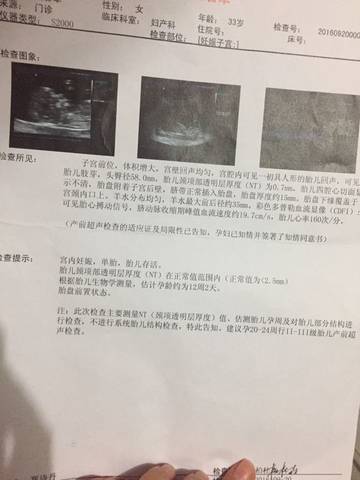 journal_insert_pic_584050050