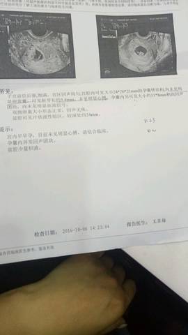 journal_insert_pic_584502924
