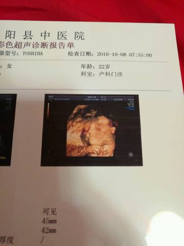 journal_insert_pic_585994841