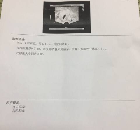 journal_insert_pic_586783154