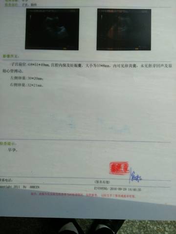 journal_insert_pic_587081393