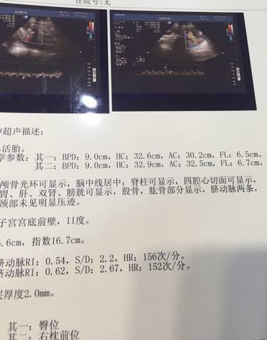 journal_insert_pic_588702098