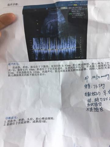 journal_insert_pic_590275471