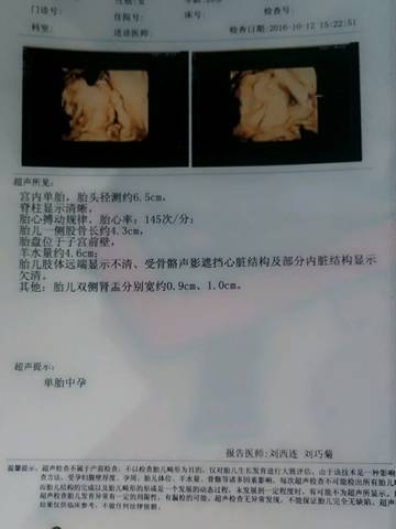 journal_insert_pic_590382658