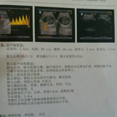 journal_insert_pic_592180636
