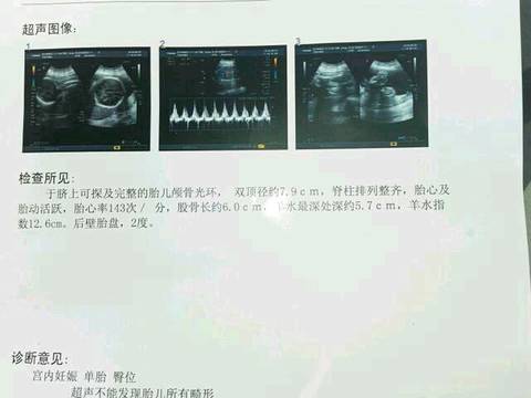 journal_insert_pic_592453912