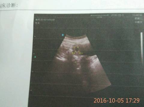 journal_insert_pic_592873597